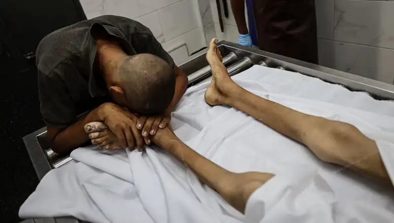 Gazze'de Açlık Korkunç Boyutlara Ulaşıyor: Bir Çocuk Daha Hayatını Kaybetti