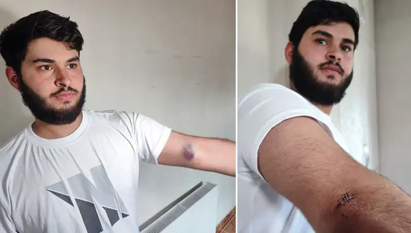 Bahçeye Kaçan Top, Mahallede Büyücek Bir Kargaşaya Sebep Oldu